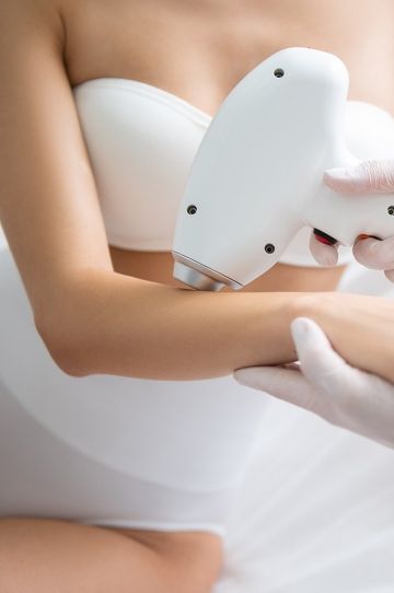 Laser hair removal on arms