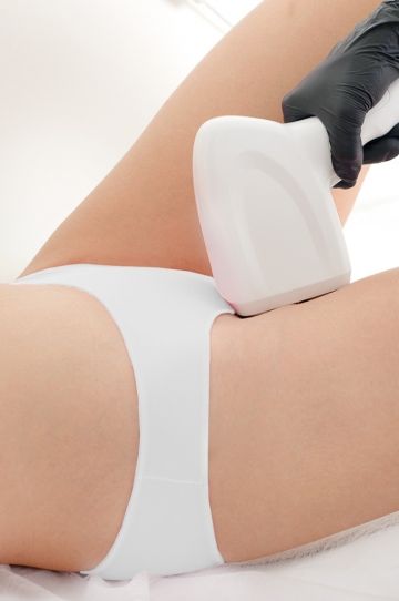 Laser bikini groin hair removal