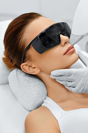 Laser hair removal above lip